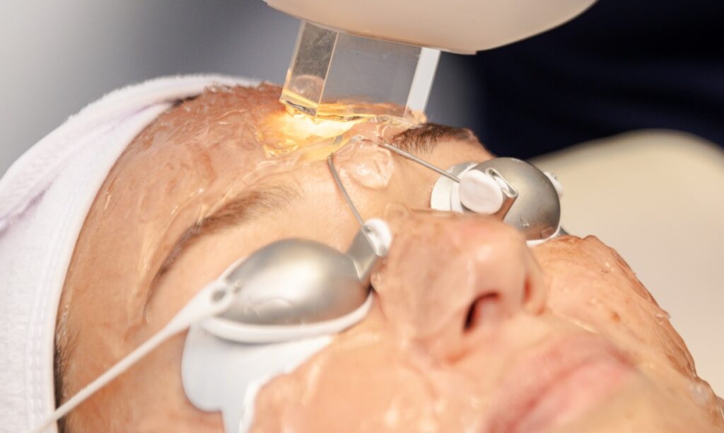 A woman wears goggles to shield her eyes during a hyperpigmentation laser treatment in Coeur d'Alene.